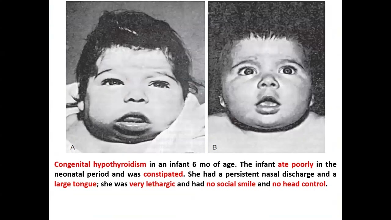 Endocrine (Cases / Revision) part 2