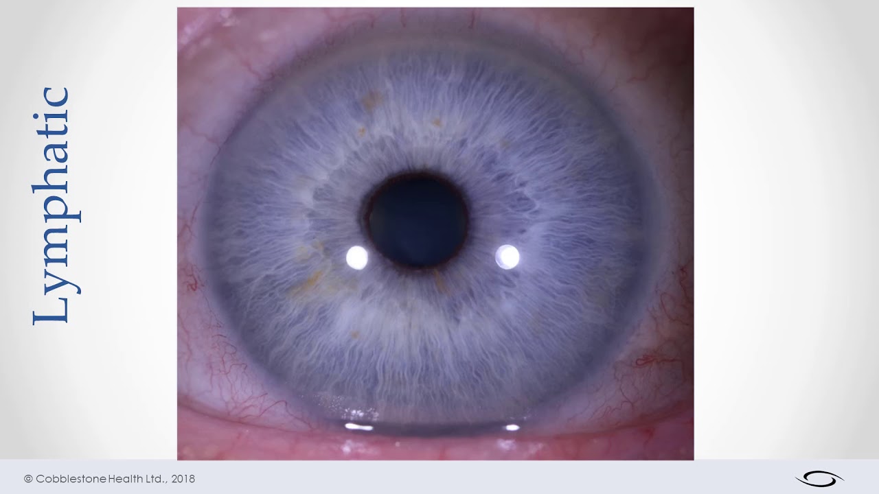 The 3 Constitutions of Constitutional Iridology: Blue eyes, Brown eyes, Hazel eyes