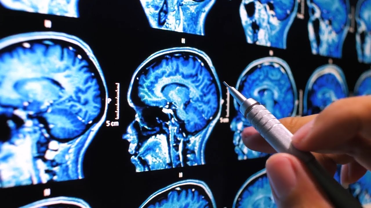 The Johns Hopkins Hospital Comprehensive Stroke Center