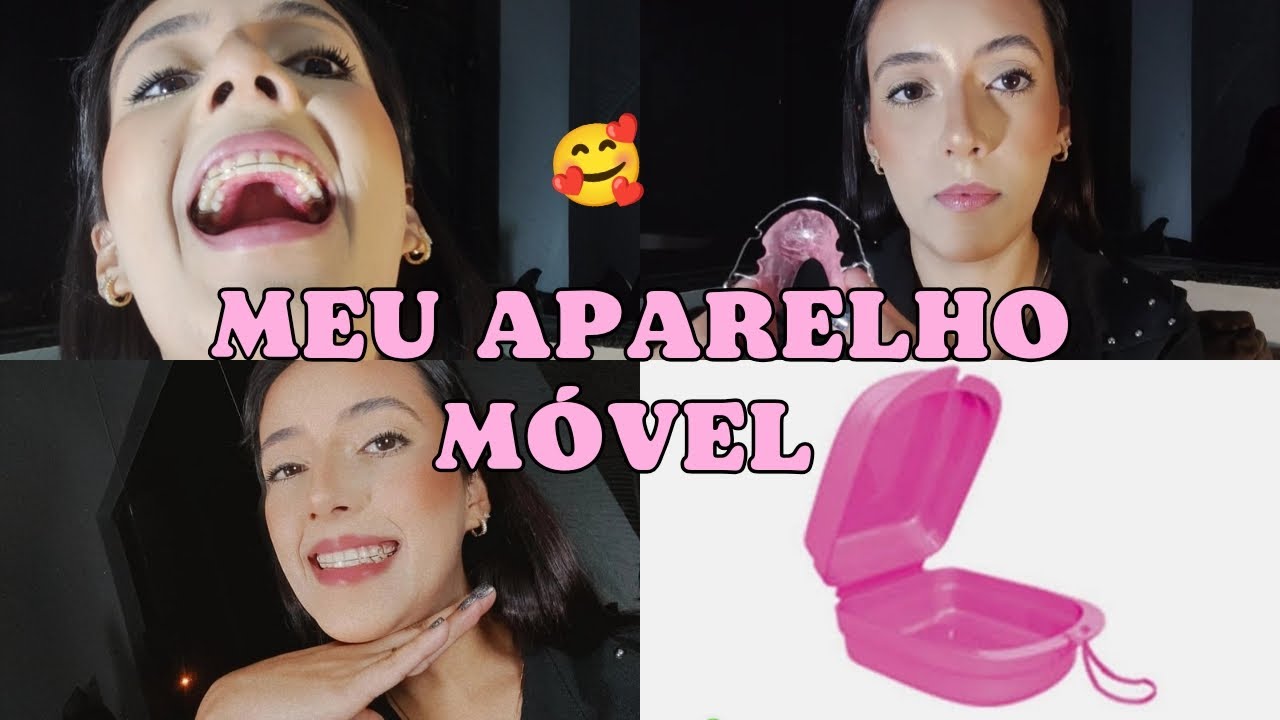 MOSTREI A CONTENÇÃO E APARELHO MÓVEL + CONTEI TUDO 😱🥰🤢