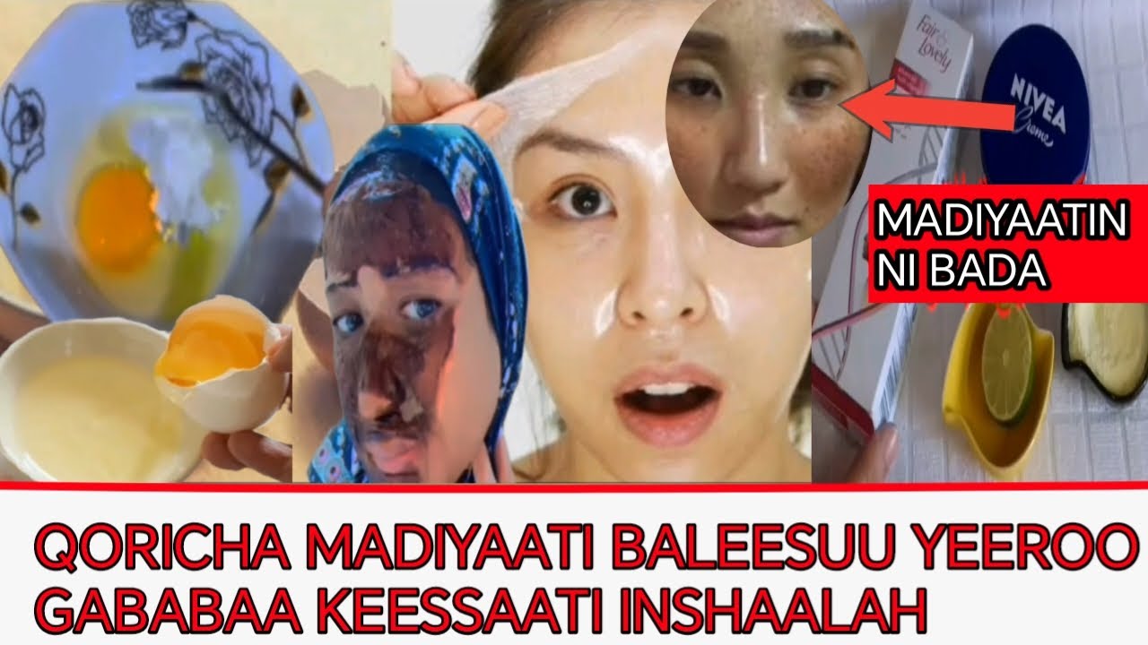 QORICHA MADIYAATI BALEESUU YEEROO GABABAA KEESSAATI INSHAALAH