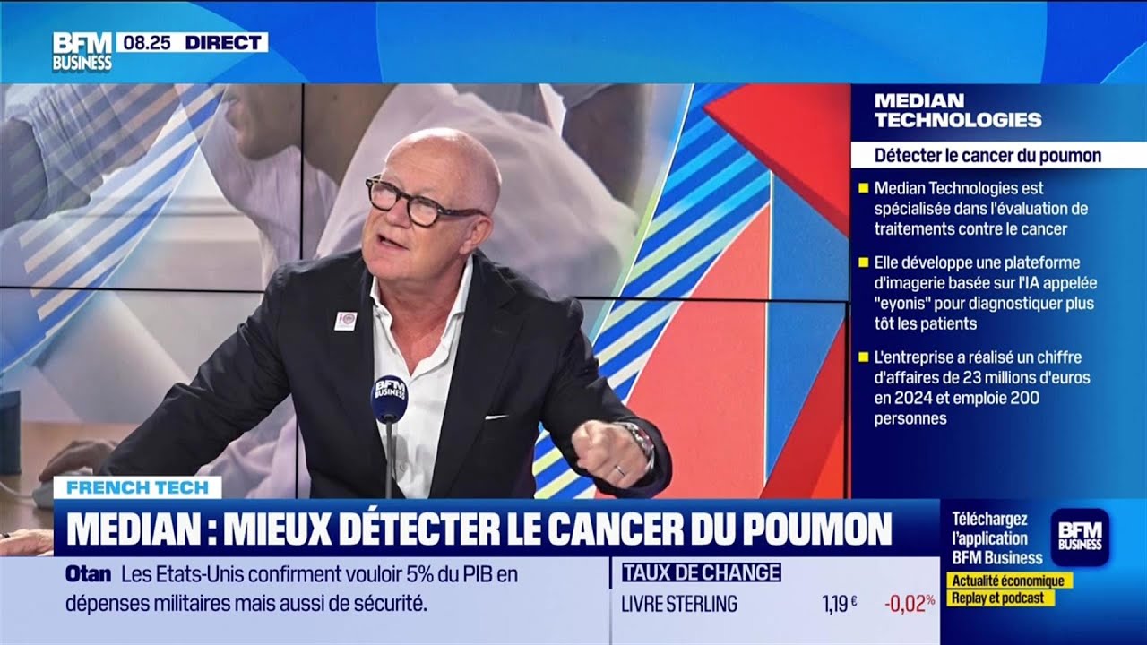 French Tech : Median, mieux détecter le cancer du poumon