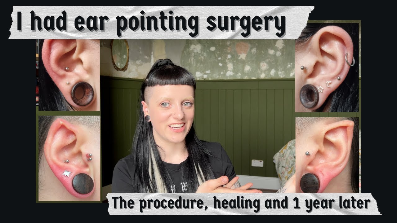My journey to getting real elf ears | from planning to 1 year on