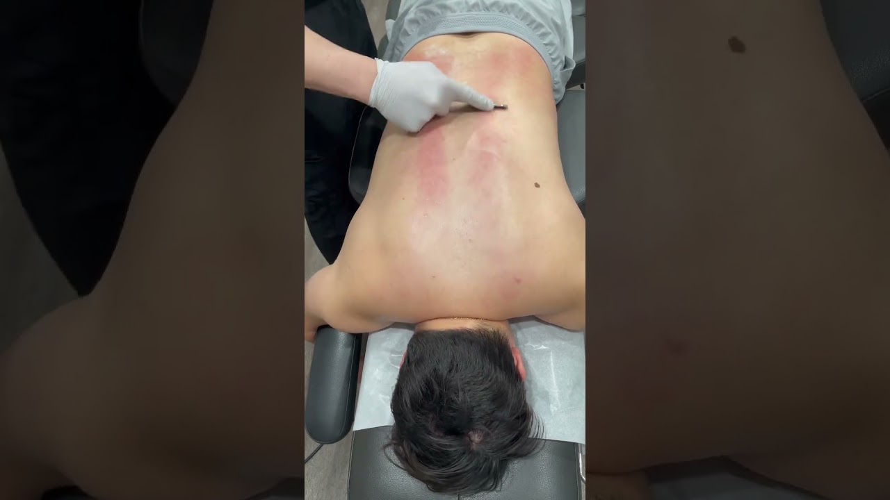 Satisfying Myofacial Scraping! #chiropractic #satisfying #shorts #asmr #trending #scraping