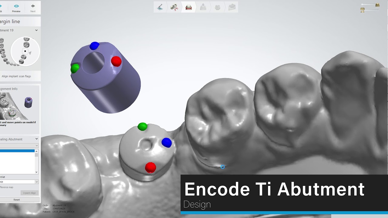 CAD/CAM Designing