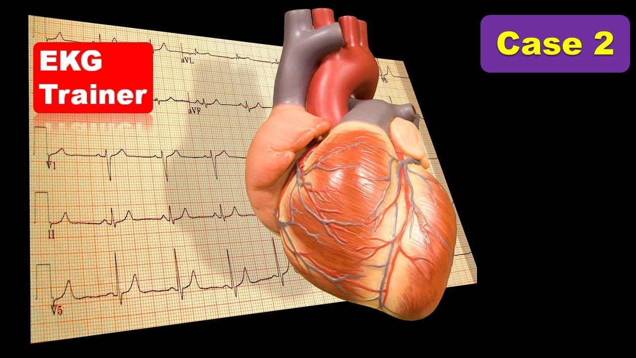EKG Trainer Case (2)   #cme #internal_medicine #usmle #medicalcollege #محاضرات_باطنة