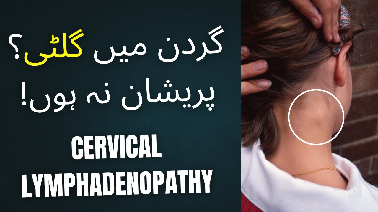 Cervical Lymphadenopathy Explained | Causes, Diagnosis & Treatment by Prof. Dr. Amna Javed