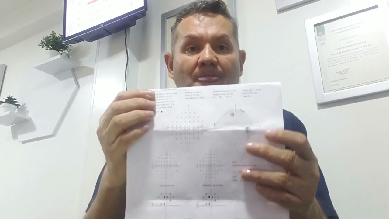 COMO LEER UN CAMPO VISUAL COMPUTARIZADO?