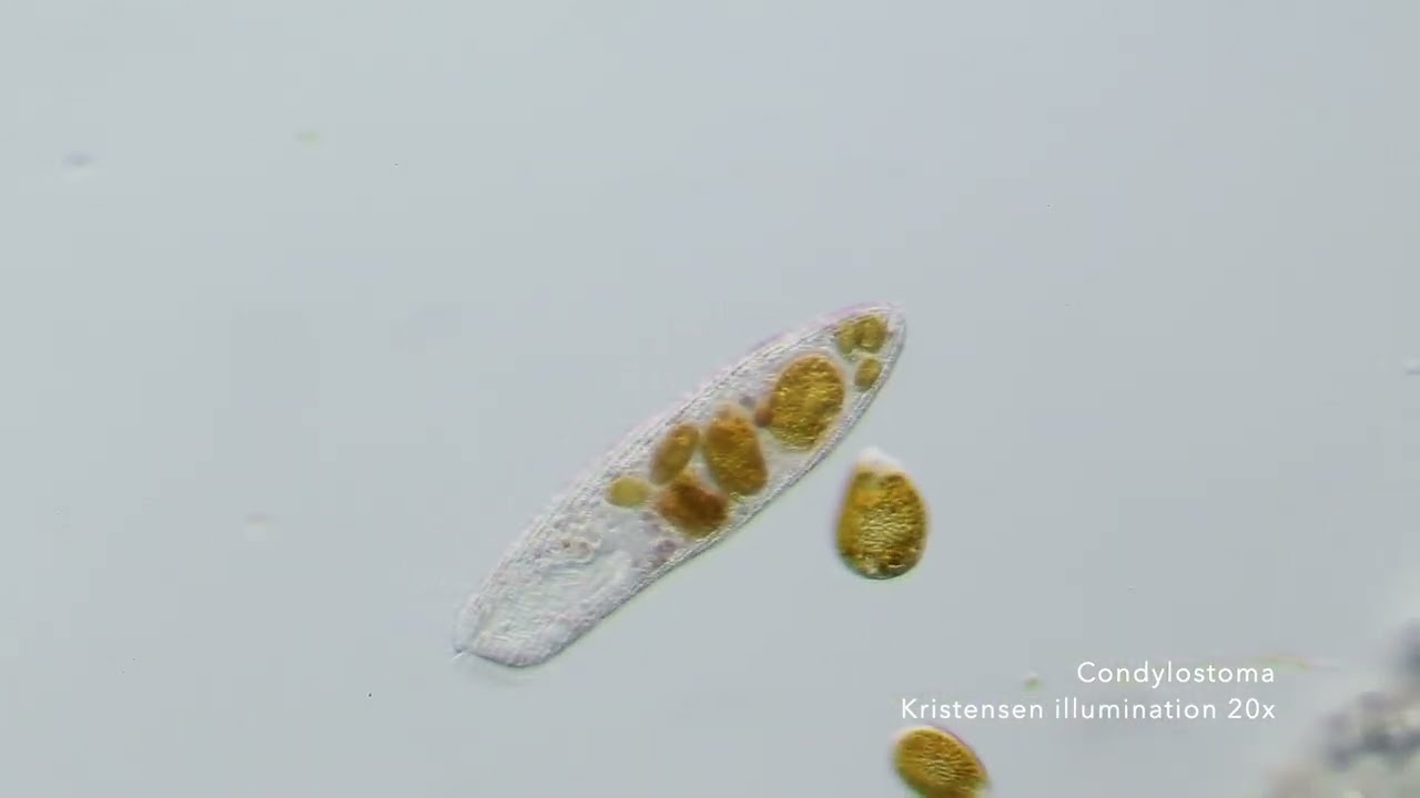 Saltwater tank sample under my Olympus BH2 microscope
