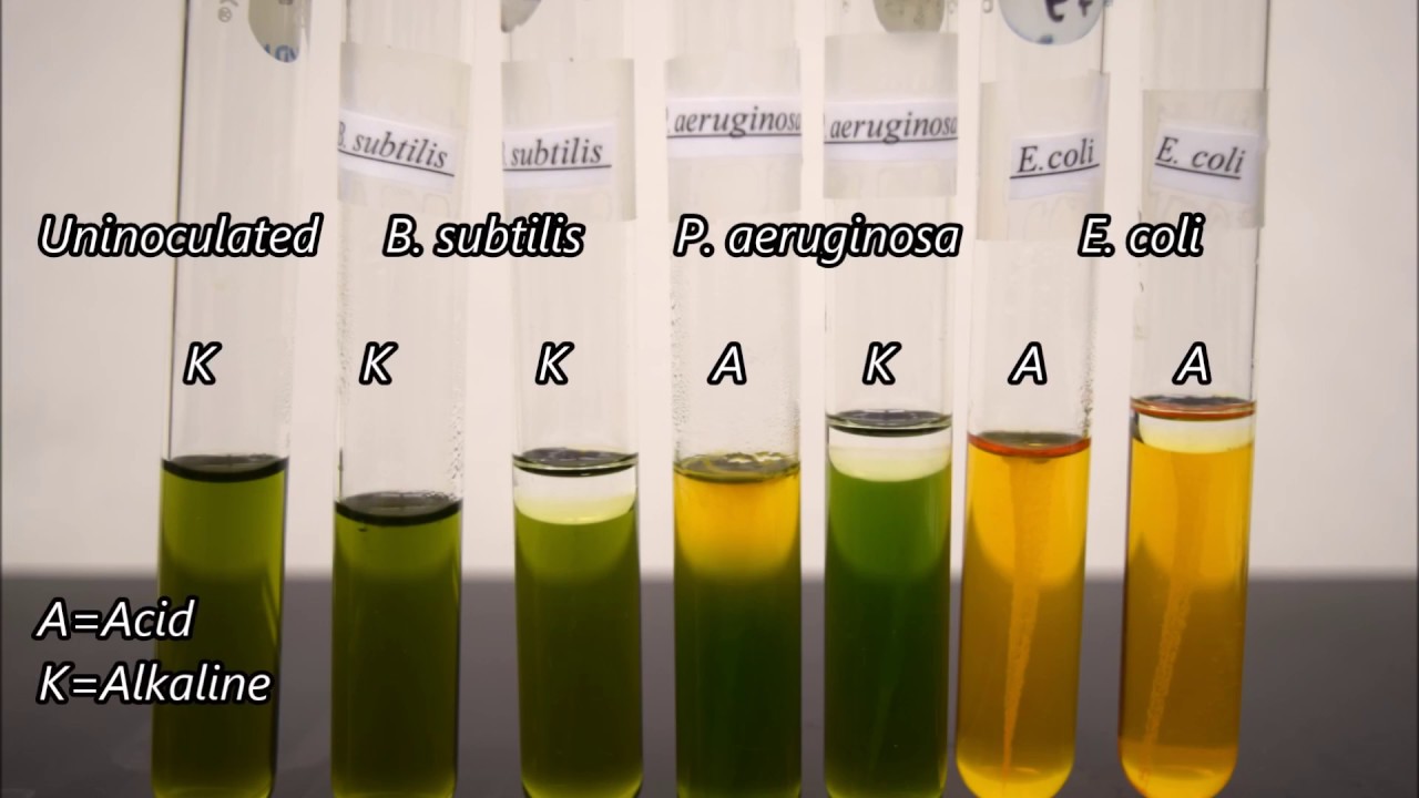 Microbiology Oxidation and Fermentation Tests Time-lapse