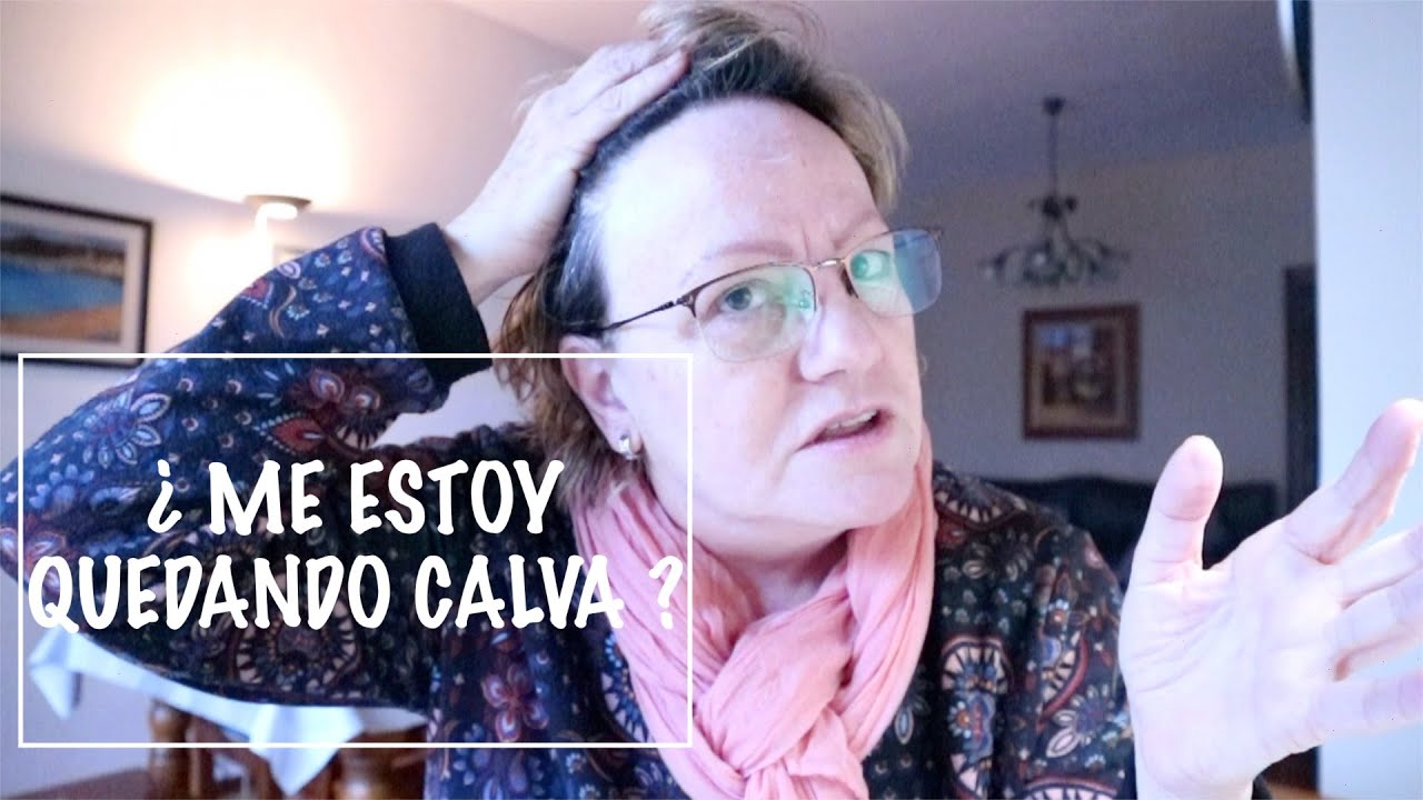 Diagnóstico: Alopecia frontal fibrosante 😞| Magalí Moon