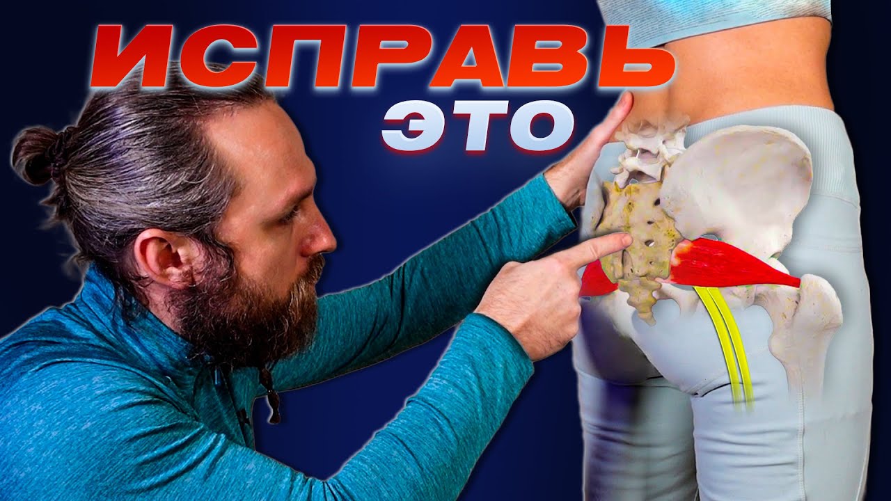 ХВАТИТ ТЕРПЕТЬ! Устрани ущемление седалищного нерва и спазм грушевидной