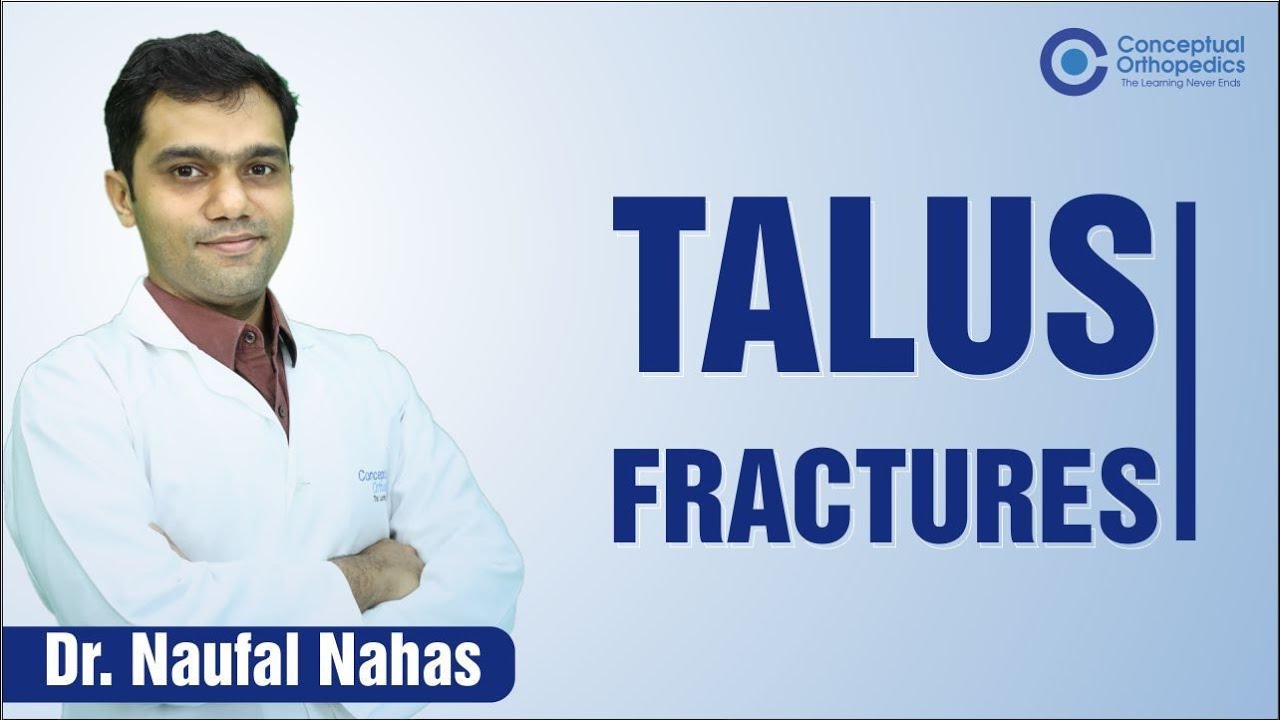 Talus Fractures by Dr. Naufal Nahas  @Conceptual Orthopedics