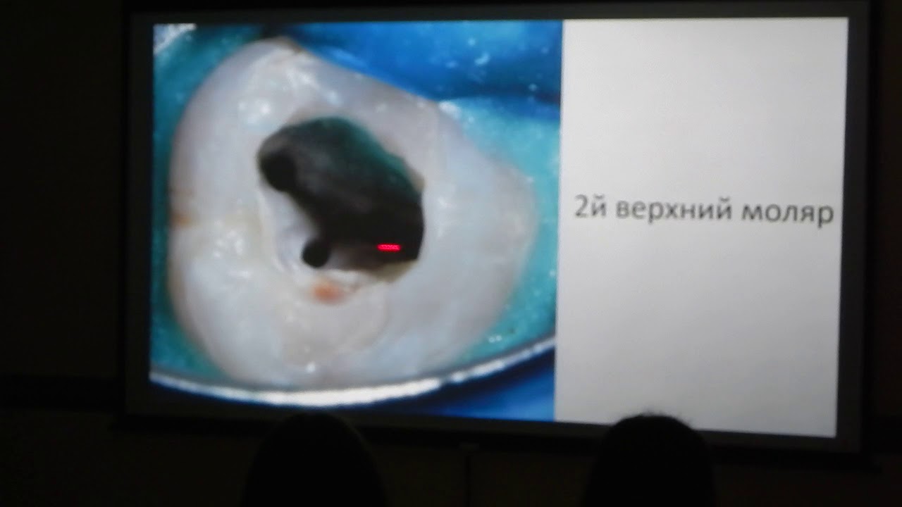 Стоматологический семинар+мастер-класс : 1-2 декабря 2018г. лектор Дентсплай Сирона Попов Роман