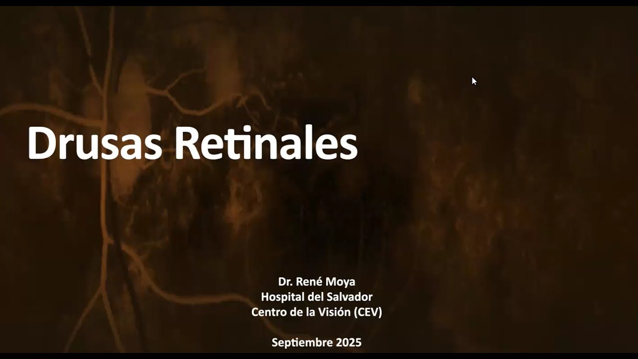 Drusas retinales Dr. René Moya