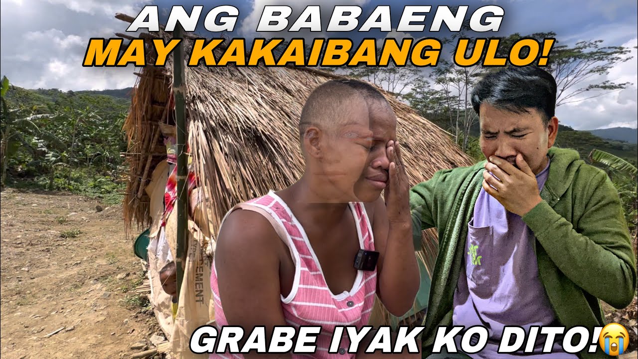 ANG BABAENG MAY KAKAIBANG ULO NAUUBOS ANG KANYANG MGA BUHOK!GRBE IYAK KO DITO