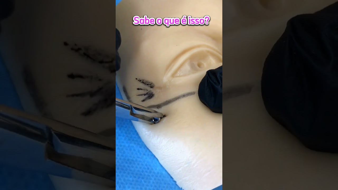 🔴Microdermal🔴 (INCR&Iacute;VEL) #piercing #bodypiercing #microdermal