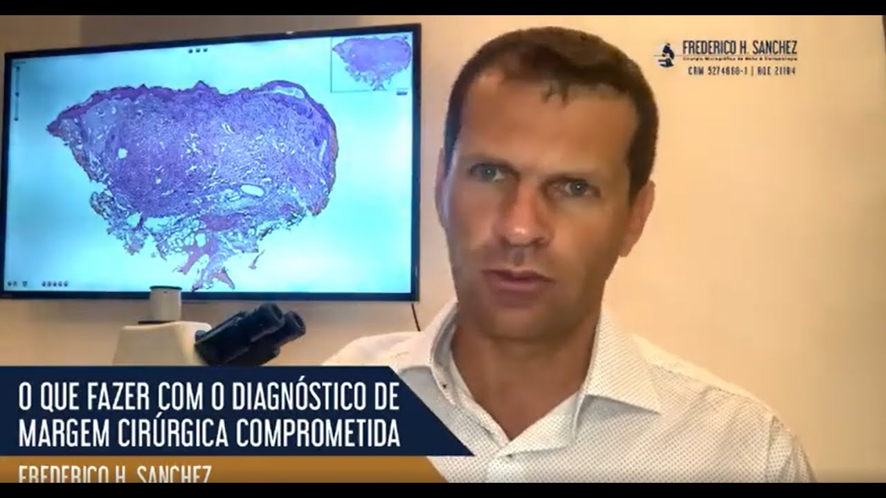 O que significa margens cirúrgicas comprometidas pelo tumor, e qual a conduta ideal nessa situação ?