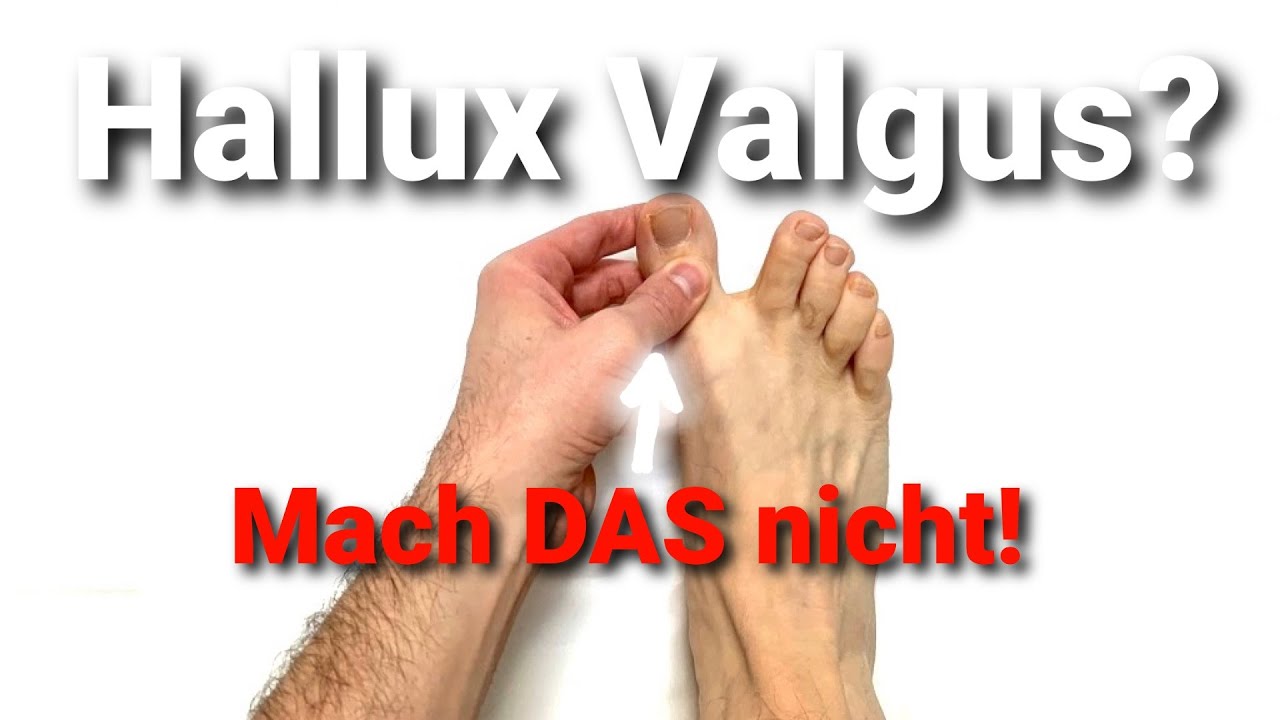 Hallux Valgus WEGTRAINIEREN (OP vermeiden) | Das 3-Schritte-Training vom Physio