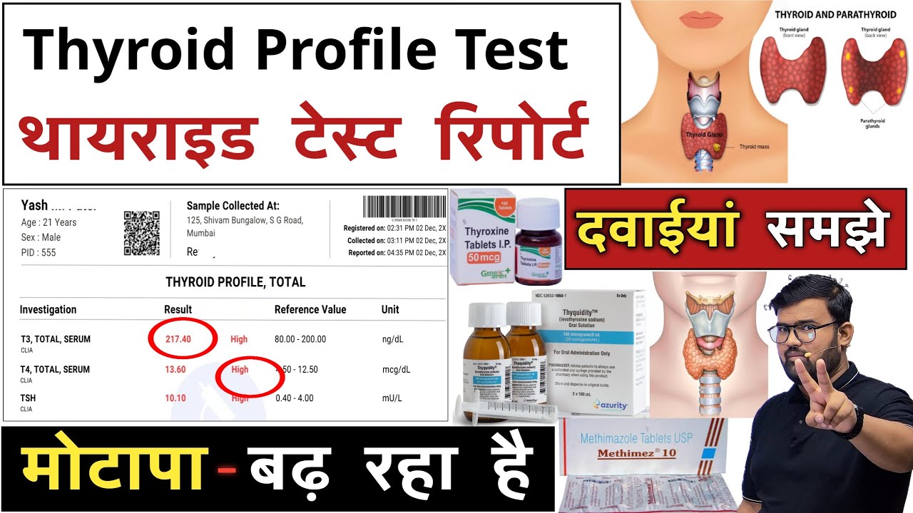 थायराइड रिपोर्ट | Thyroid Profile Test | Thyroid Test | T3 | T4 | TSH | Treatment | Medicine | MBBS