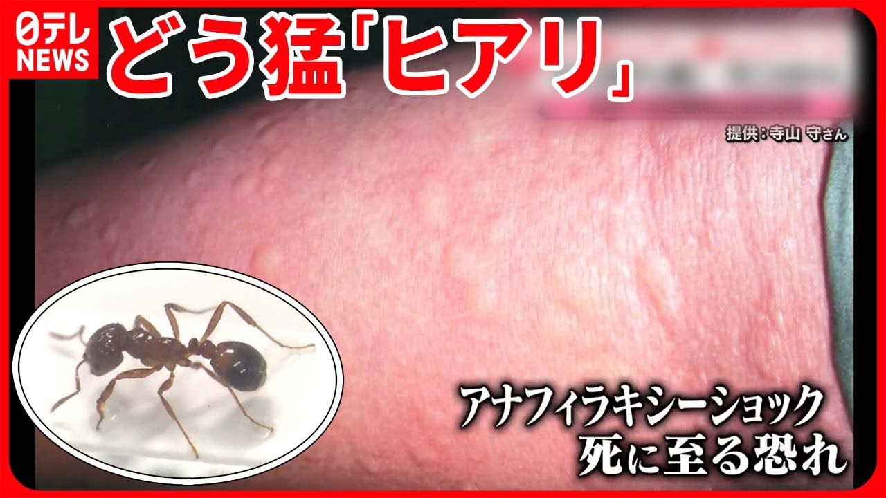 【ヒアリ】死に至る恐れも…都内で発見相次ぐ  「ヒアリ探知犬」で定着阻止へ…