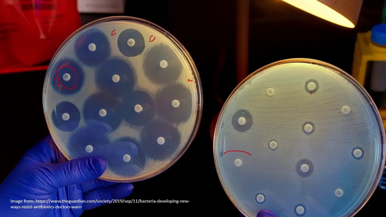 Chapter 10.3: Antibiotics and Antibiotic Resistance