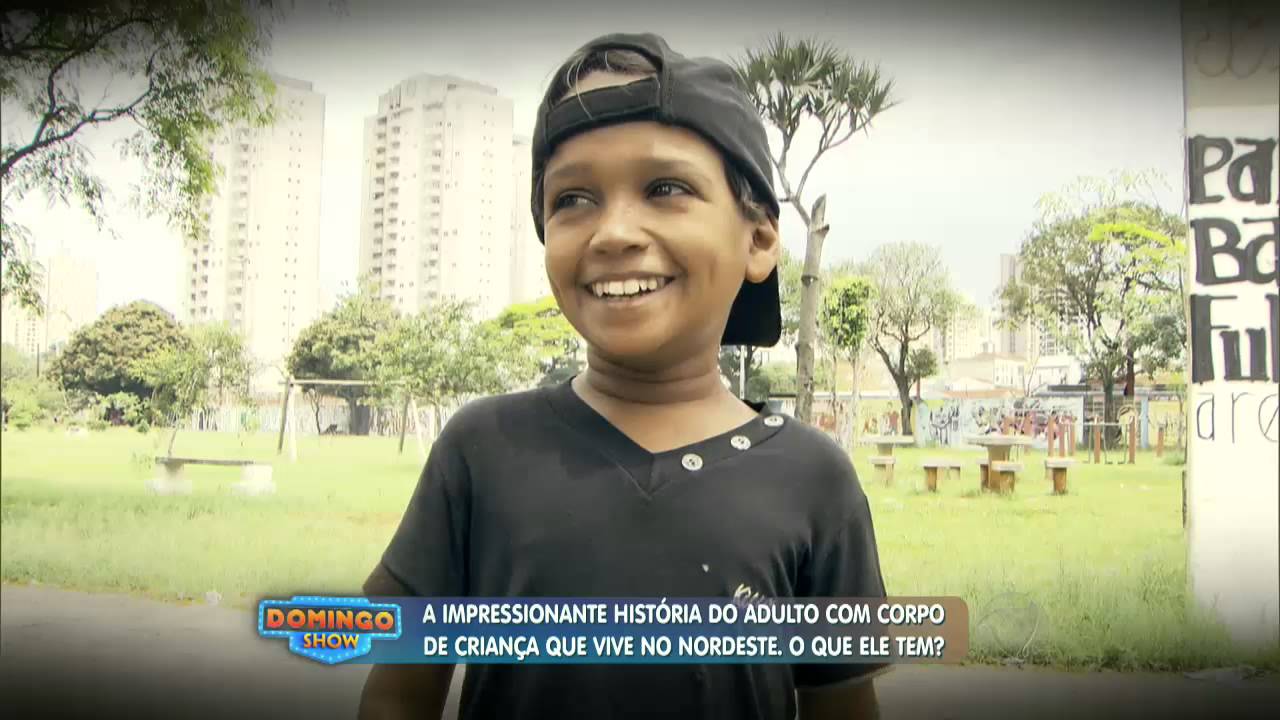 A história do adulto com corpo de criança. O que ele tem?