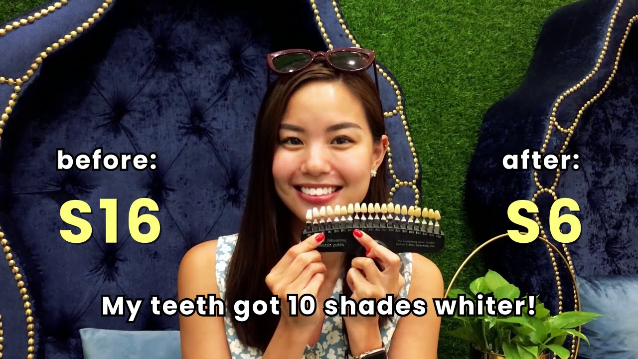 LED Teeth Whitening with Fang Rong