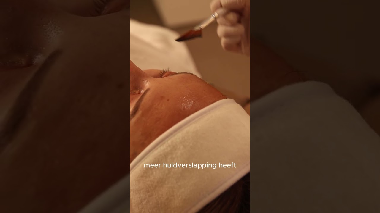 Wie zegt dat peelings alleen voor de winter zijn?