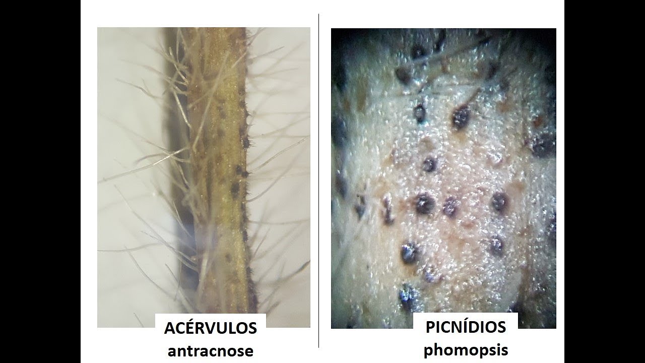Soja HOJE: Antracnose ou Phomopsis. Como identificar!?