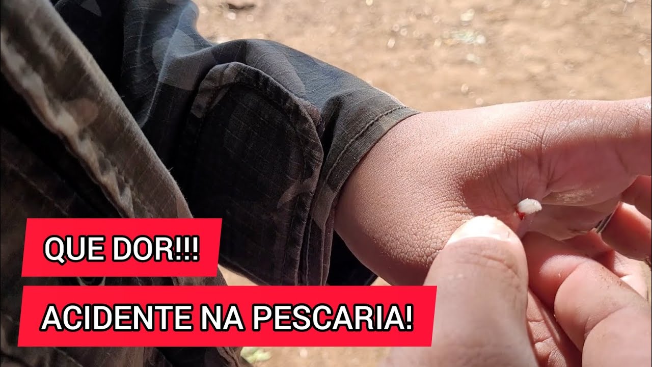 A DOR É ALUCINANTE! Pescaria cheia de ação e um acidente no Rio Caí, Nova Santa Rita.