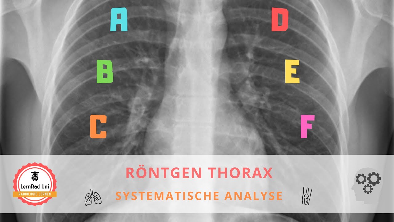 Systematische Auswertung Röntgen Thorax – so gehst du vor!