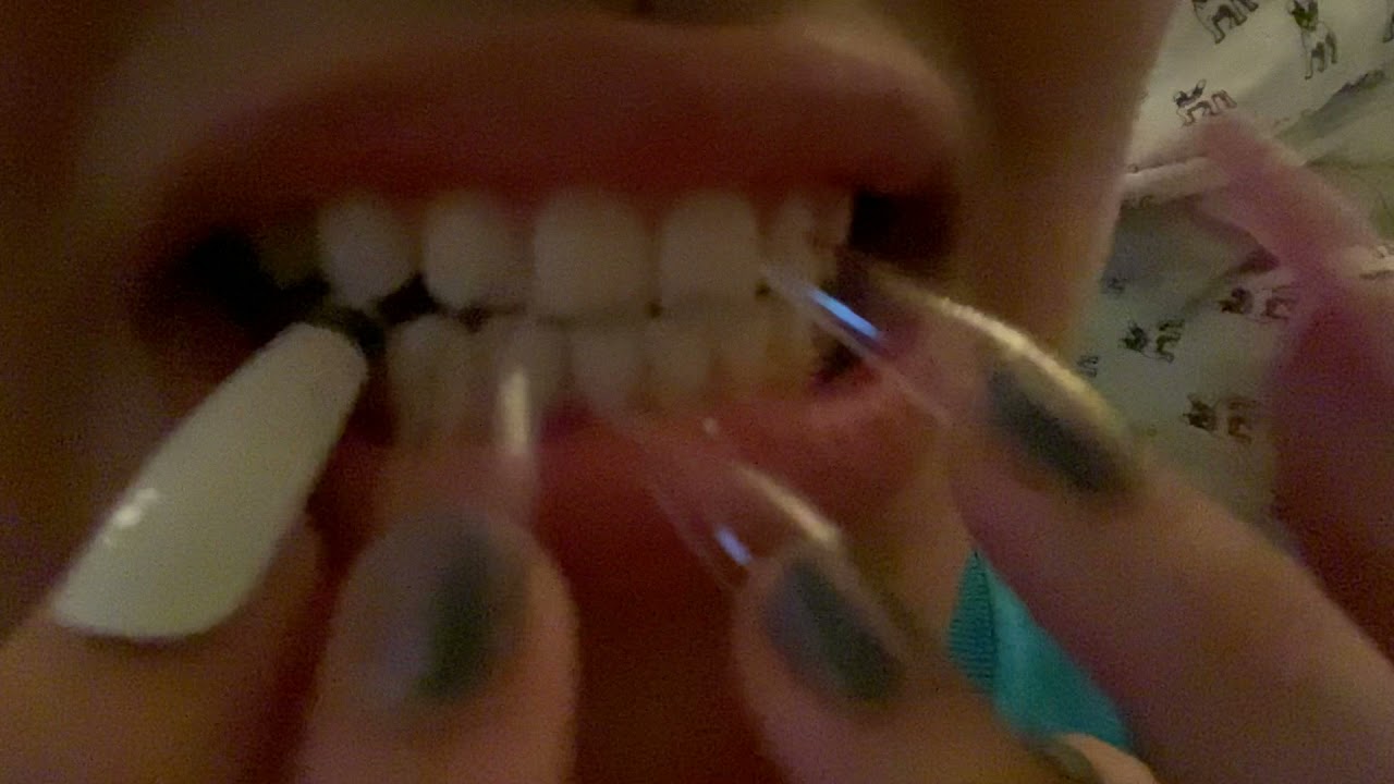 ASMR  UP CLOSE 📸 teeth tapping + teeth scratching 🦷 + camera tapping + nail biting 💅🏻