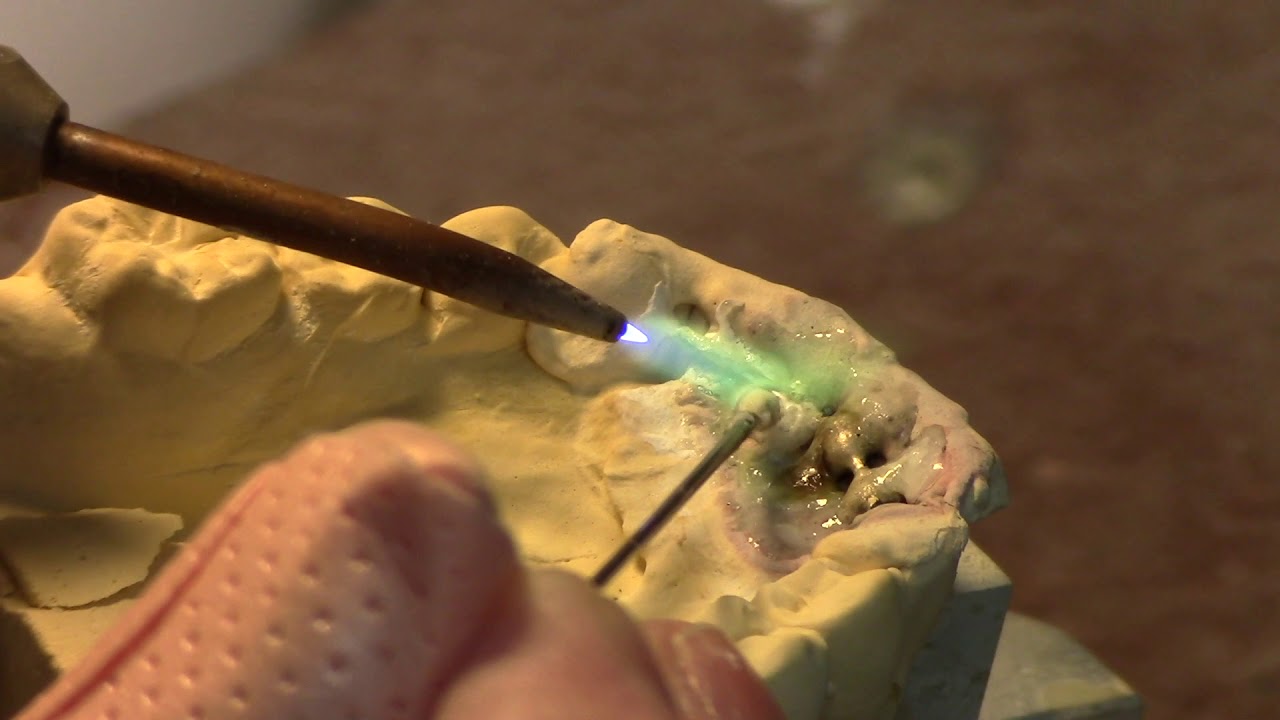 Soldering 6-pad Bonded Lingual Retainer