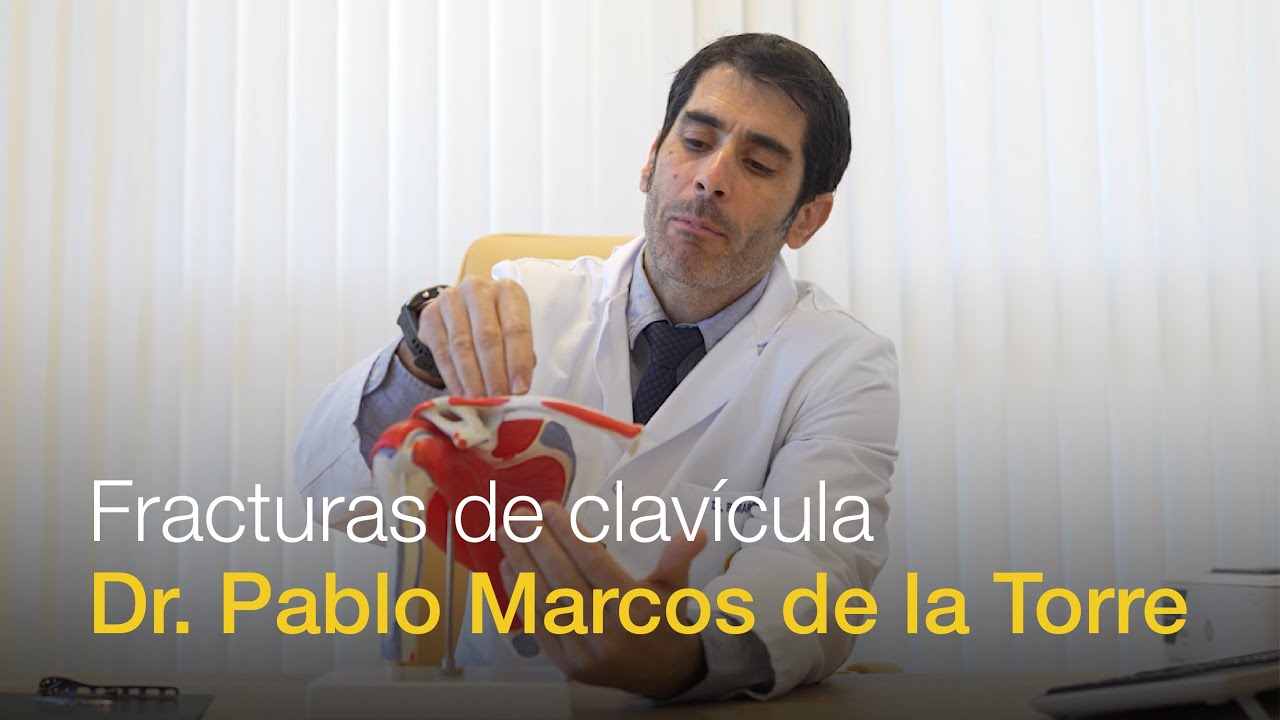 Fractura de clav&iacute;cula: causas, tratamiento y recuperaci&oacute;n | Dr. Marcos de la Torre &ndash; Cl&iacute;nica CEMTRO