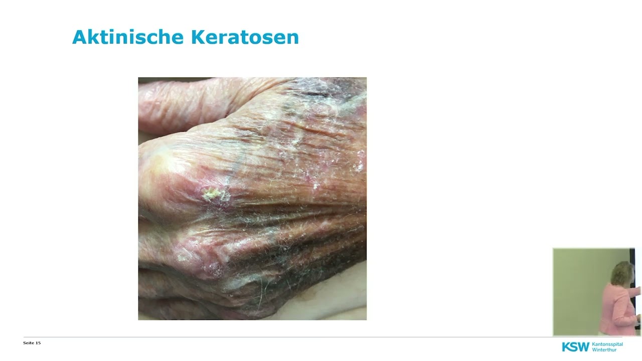 Vorsorge und Früherkennung bei Krebs