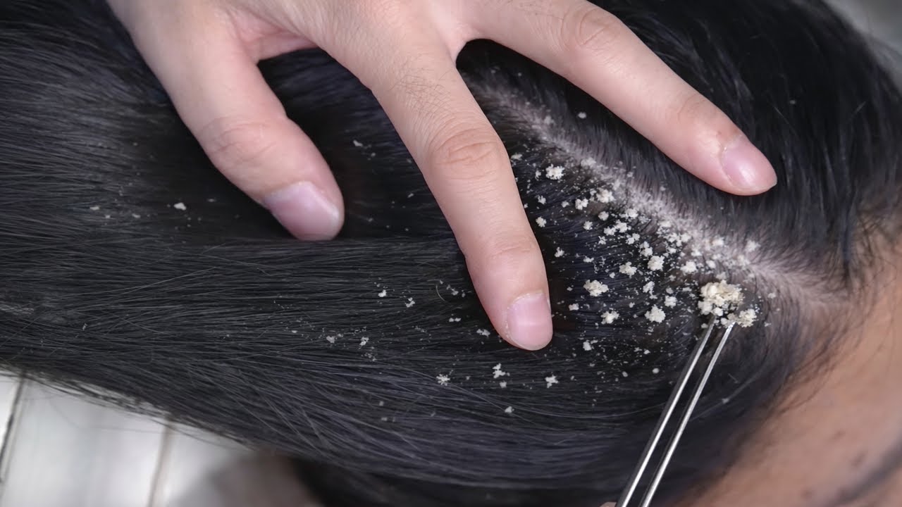 Professional Scalp Care ASMR | Deep Cleaning for Relaxation