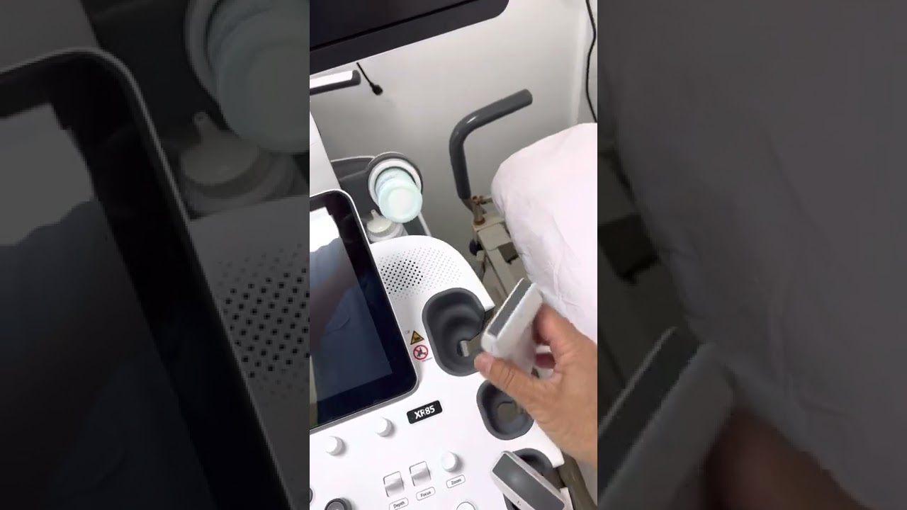 我来介绍一下B超