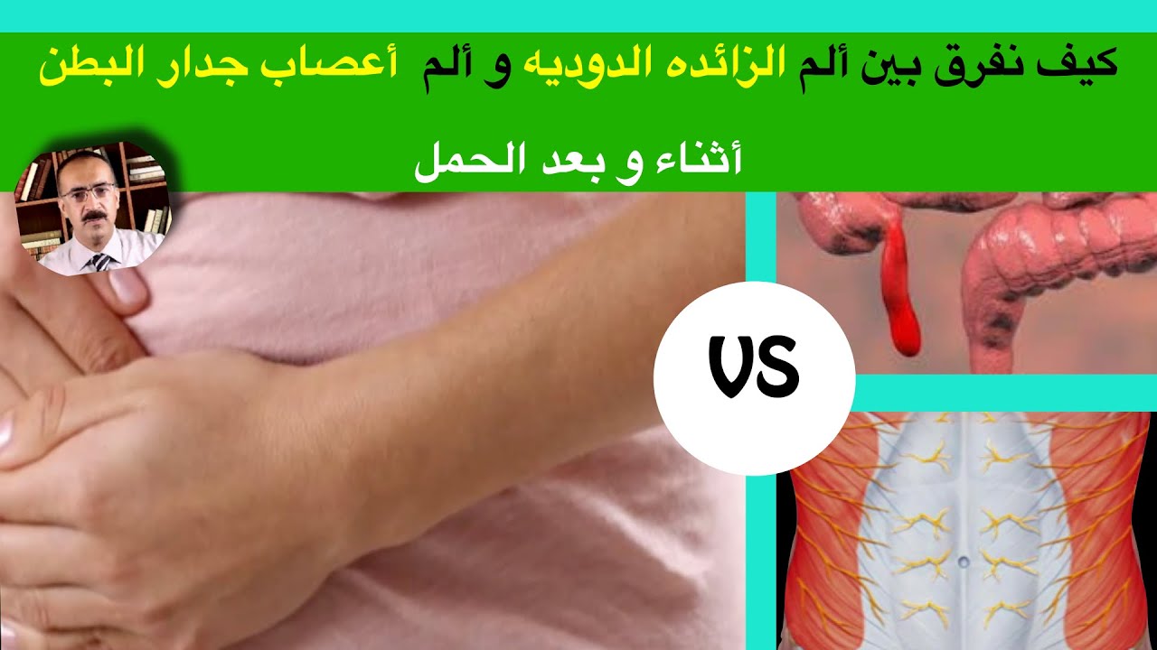 ‏كيف نفرق بين ألم الزائدة الدوديه و ألم أعصاب جدار البطن أثناء وبعد الحمل؟