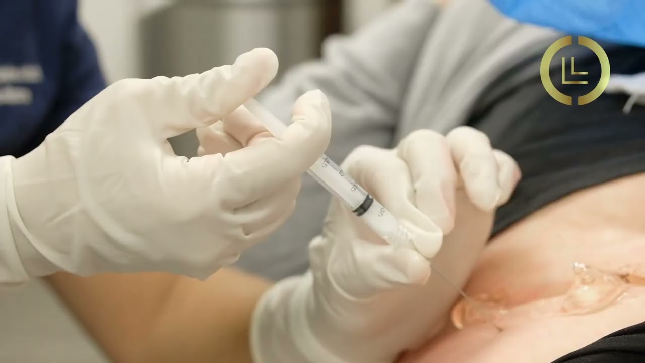 Xylo test with cortisone for hip