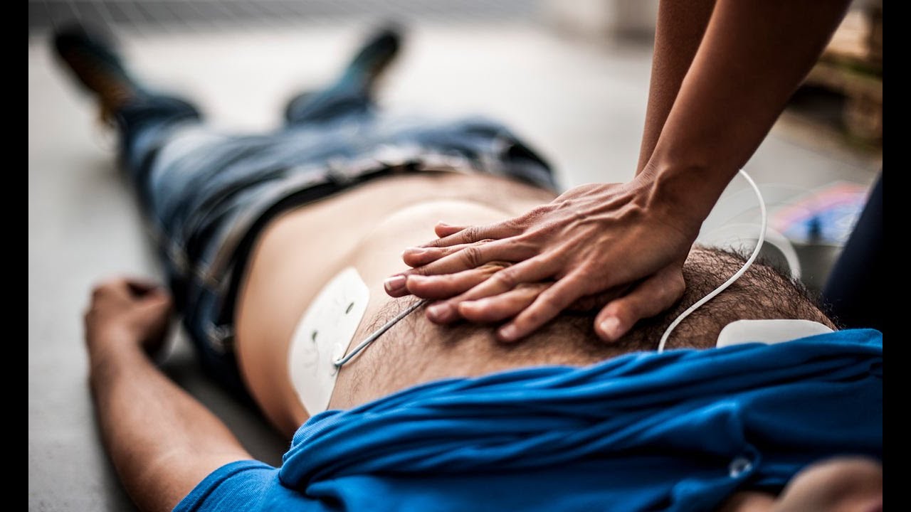 Reanimación temprana con ECMO mejora la supervivencia adultos con paro cardíaco