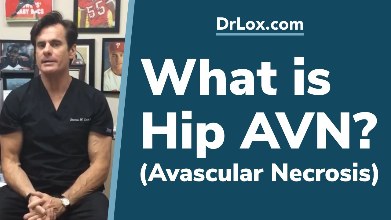 What is Hip AVN? Dr. Lox Explains Avascular Necrosis of Hip