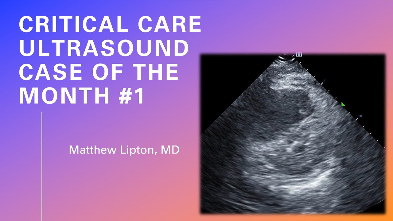 Case of the month #1 (w/ narration)