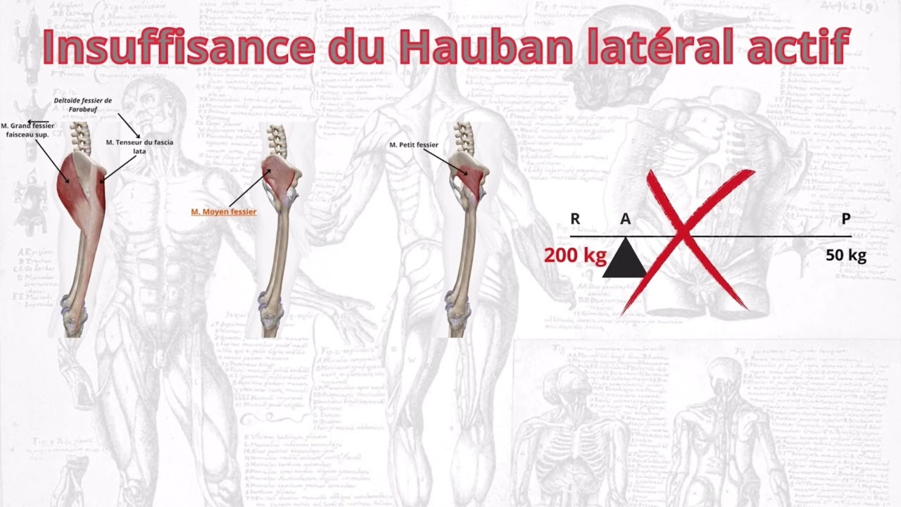 Br&egrave;ve analyse de la balance de Pauwels