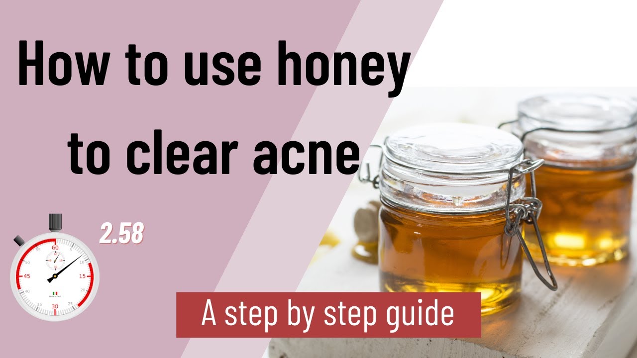 HOW TO USE HONEY TO CLEAR ACNE [A step by step guide]