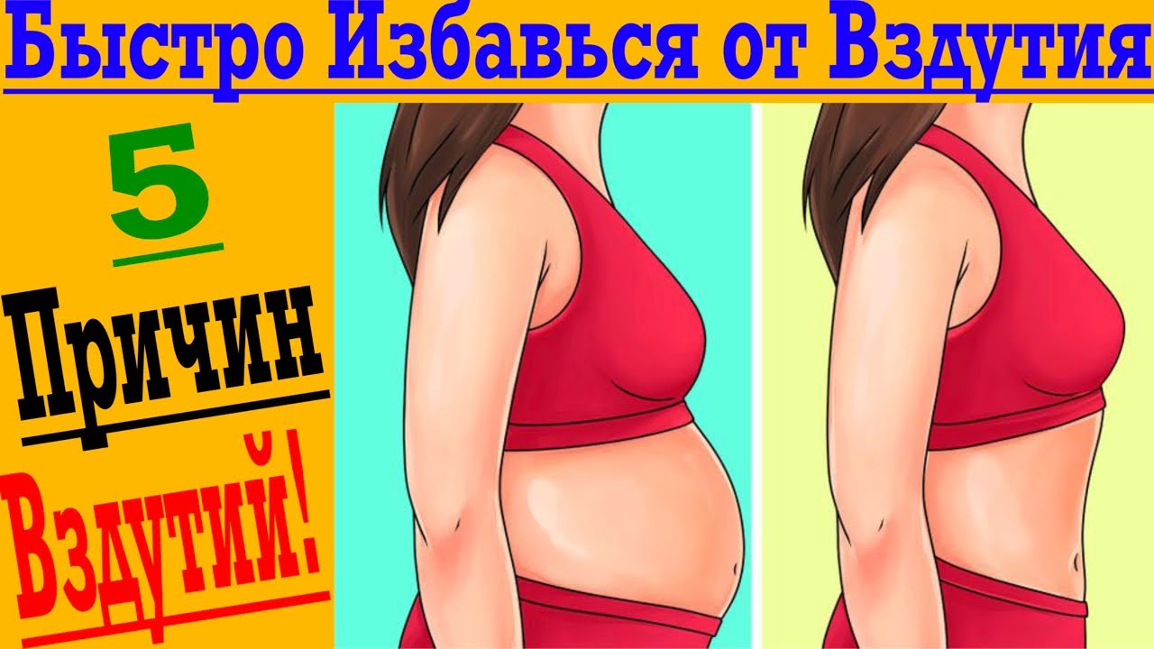 Как БЫСТРО победить ВЗДУТИЯ ЖИВОТА!
