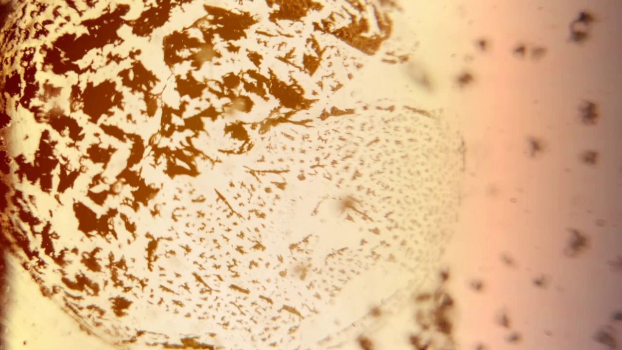 INCREASING TESTOSTERONE LEVELS IN MEN | MAGNETO-DIELECTRIC FIELD