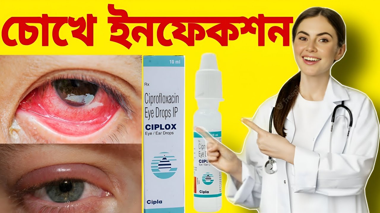 Ciplox eye drops | ciplox eye drops uses in bengali | eye drops | চোখের ড্রপ | @rightmedicine96