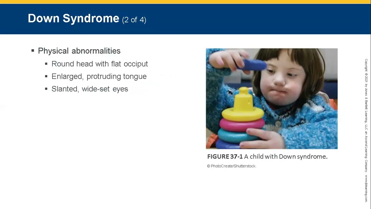 EMT Chapter 37: Patients with Special Challenges