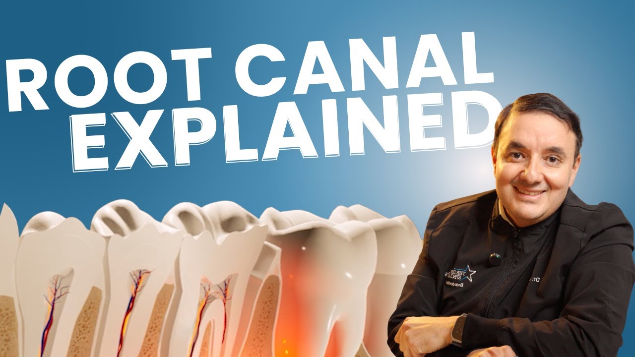 Root Canals Explained: The Truth Behind the Most Misunderstood Dental Treatment